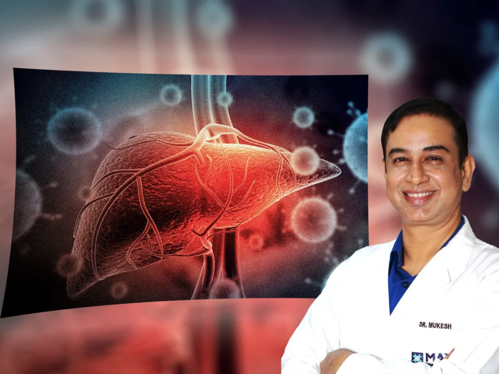 Dr. Rathore on World Hepatitis Day